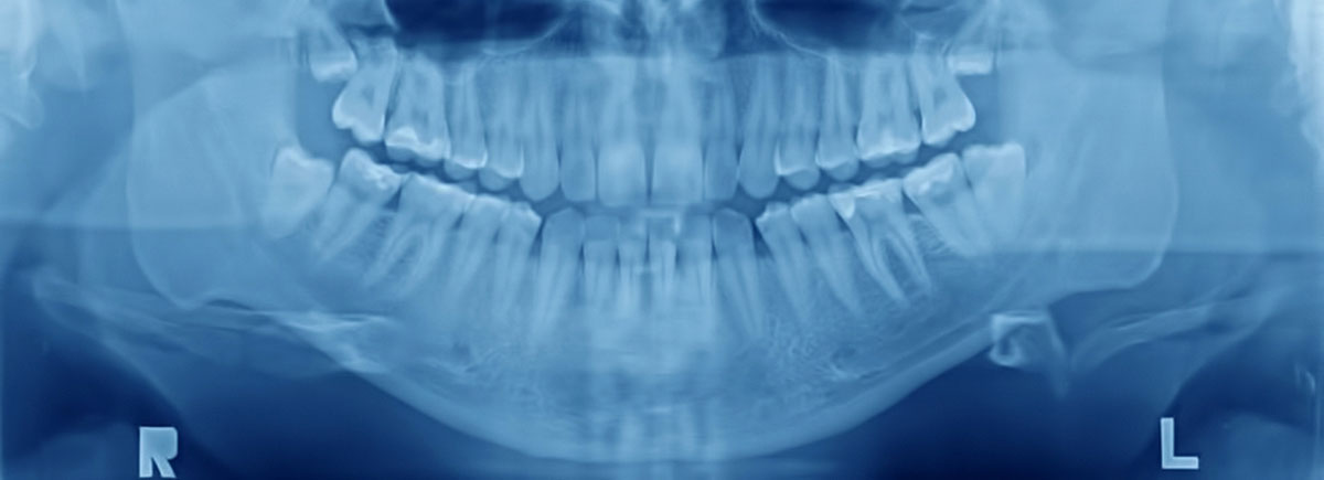 radiografia_dental